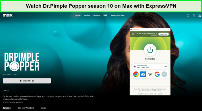 Watch-Dr-Pimple-Popper-season-10-on-Max-with-ExpressVPN-in-UAE